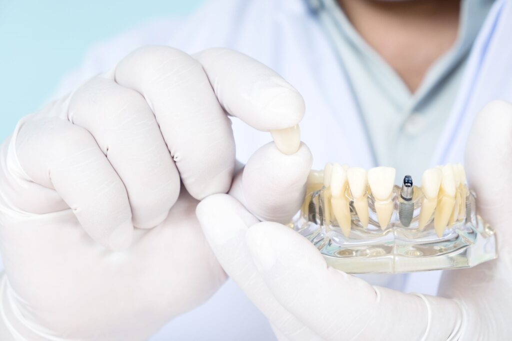 Dentist in white gloves holding sample dental implant